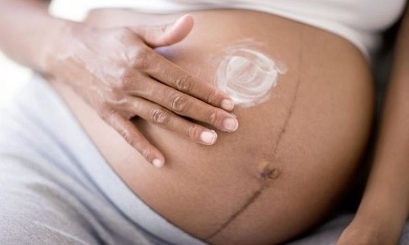 5+1 φυσικές λύσεις για να προλάβετε τις ραγάδες της εγκυμοσύνης
