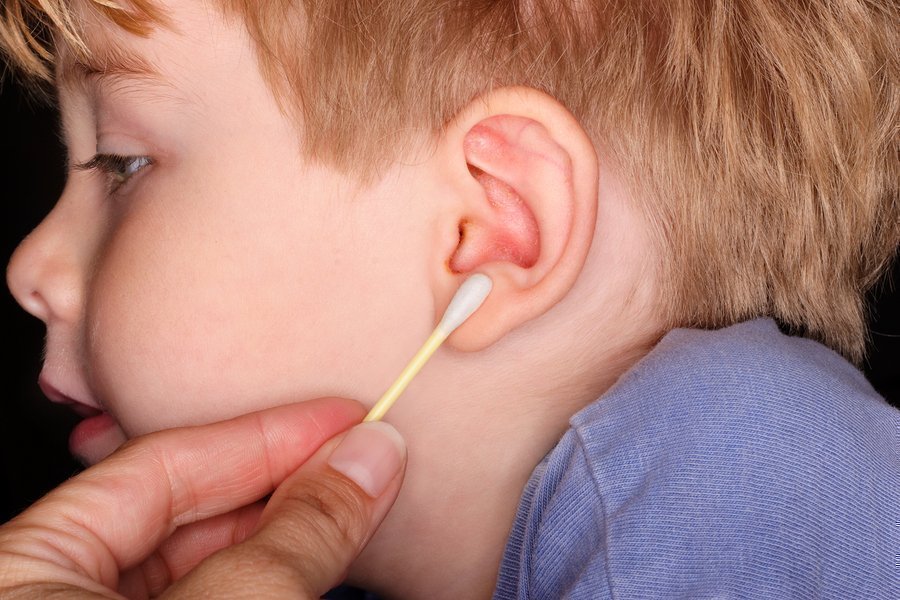 Πρέπει να αφαιρείται το κερί από τα αυτιά των παιδιών;