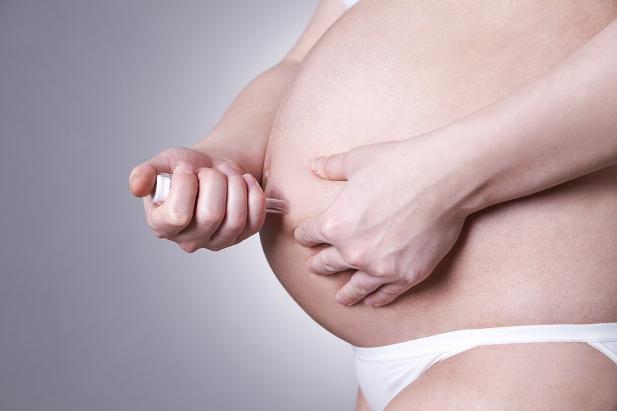 Ποιον κίνδυνο μειώνει η άσκηση πριν την εγκυμοσύνη;