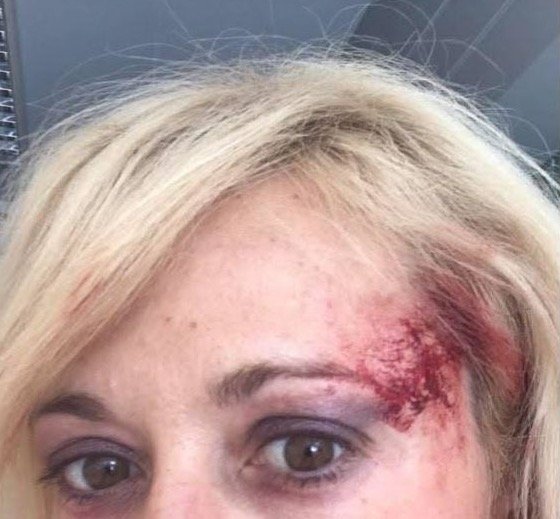 Σοκαριστικές εικόνες: Χτύπησαν επώνυμη Ελληνίδα μέσα στο αυτοκίνητο Της χτυπούσαν το κεφάλι....