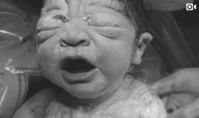 Σίγουρα δεν έχετε ξαναδεί αντίστοιχο βίντεο γέννησης μωρού!
